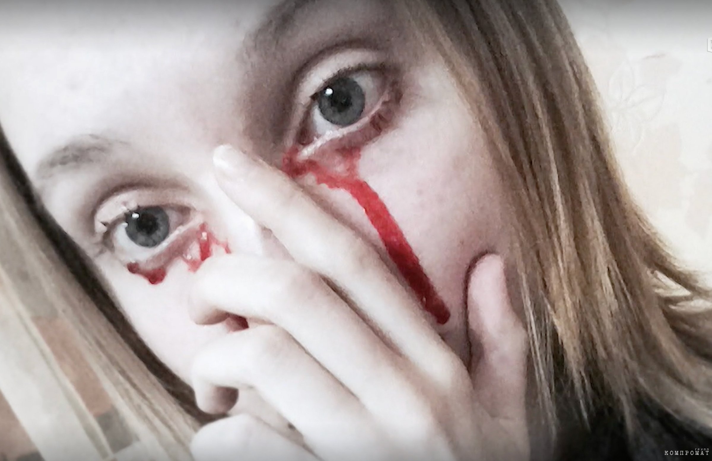На фотографии видно, что "кровь" под правым глазом девушки, похоже, не вытекала из слёзного канала, а выглядит так, будто была нанесена искусственно.
